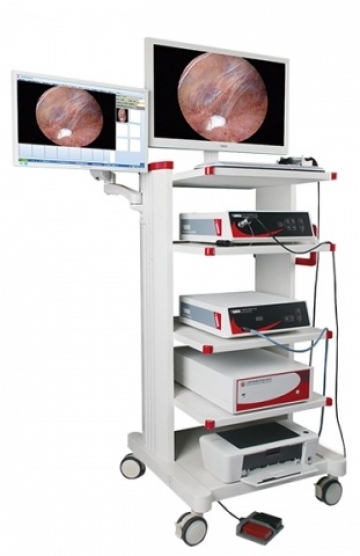 ARTHROSCOPE